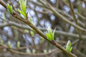舌苔の原因と口呼吸がもたらす影響とは？